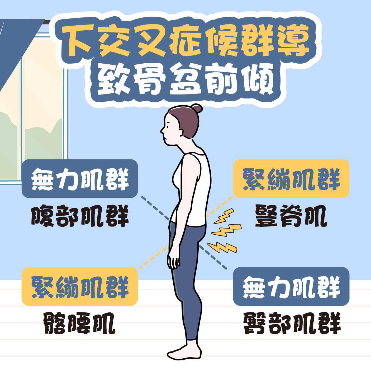 骨盆前傾又稱下交叉症候群
