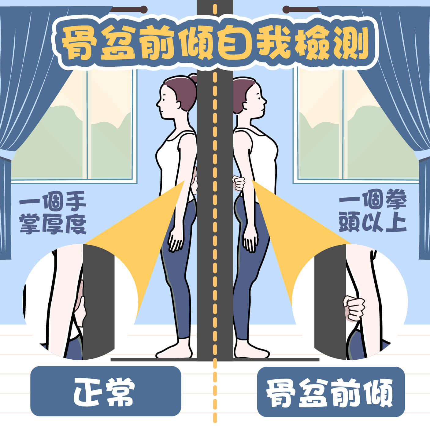 骨盆前傾自我檢測法